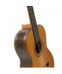 Bundle chitarra classica cuenca 45 ziricote